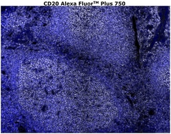Invitrogen CD20 Monoclonal Antibody (L26), Alexa Fluor Plus 750 500 &mu;L;