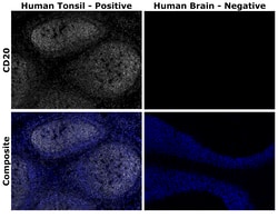 Invitrogen™ CD20 Monoclonal Antibody (L26), Alexa Fluor™ Plus 750