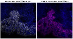 Invitrogen&trade;&nbsp;EGFR Recombinant Rabbit Monoclonal Antibody (30H45L48), Alexa Fluor&trade; Plus 750