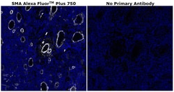 Invitrogen Alpha-Smooth Muscle Actin Monoclonal Antibody (1A4), Alexa Fluor