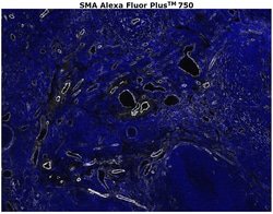 Invitrogen Alpha-Smooth Muscle Actin Monoclonal Antibody (1A4), Alexa Fluor