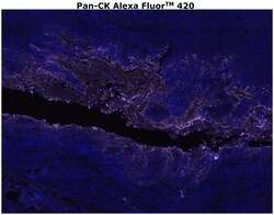 Cytokeratin Pan Type I/II Antibody Cocktail, Alexa Fluor™ 420, Invitrogen™