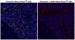 Vimentin Monoclonal Antibody (V9), Alexa Fluor&trade; 420, Invitrogen&trade;