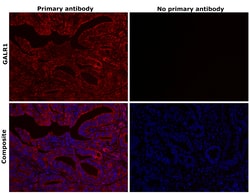 Invitrogen&trade;&nbsp;GALR1 Recombinant Rabbit Monoclonal Antibody (A1)