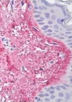 Collagen V Alpha-1 Chain (NC2 domain) Monoclonal Antibody (13F6), QED Bioscience