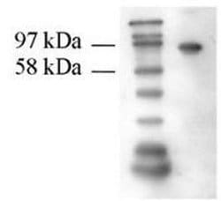 Transglutaminase-2 (TG2) Monoclonal Antibody (7D2), QED Bioscience 100