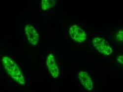 Phospho-RNA pol II CTD (Ser5) Recombinant Mouse Monoclonal Antibody, Active