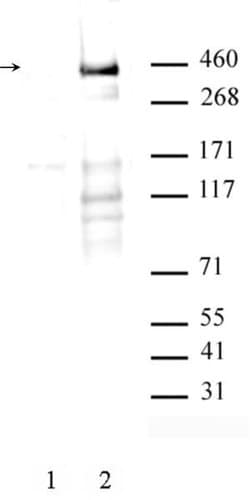 Phospho-ATM (Ser1981) Recombinant Mouse Monoclonal Antibody, AbFlex , Active