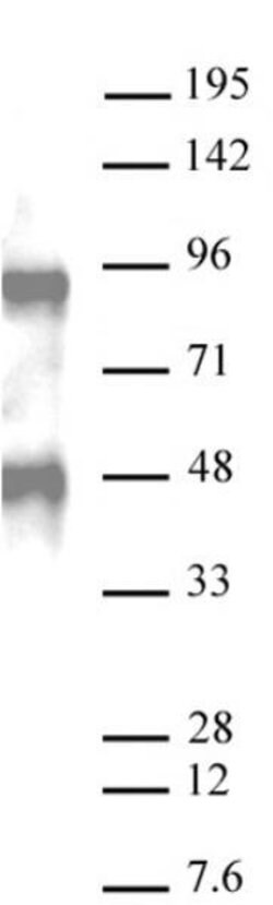 Bcl6 Recombinant Mouse Monoclonal Antibody, AbFlex , Active Motif:Antibodies:Primary