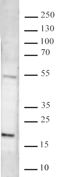 Histone H3K27me3 Recombinant Mouse Monoclonal Antibody, AbFlex , Active