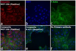 Invitrogen F(ab')2-Goat anti-Rabbit IgG (H+L) Cross-Adsorbed Secondary