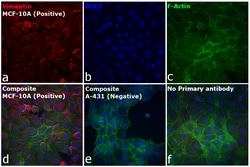 Invitrogen F(ab')2-Goat anti-Rabbit IgG (H+L) Cross-Adsorbed Secondary