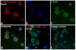 Invitrogen Goat anti-Human IgG (H+L) Cross-Adsorbed Secondary Antibody,
