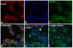 Invitrogen Goat anti-Human IgG (H+L) Cross-Adsorbed Secondary Antibody,