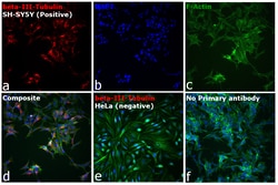Invitrogen™ Goat anti-Mouse IgG2a Cross-Adsorbed Secondary Antibody, Alexa Fluor™ 594