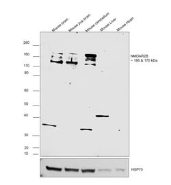 Invitrogen NMDAR2B Polyclonal Antibody 10 &mu;g; Unconjugated:Antibodies,