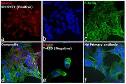 Invitrogen Donkey anti-Mouse IgG (H+L) Highly Cross-Adsorbed Secondary