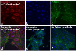 Invitrogen Donkey anti-Rabbit IgG (H+L) Highly Cross-Adsorbed Secondary