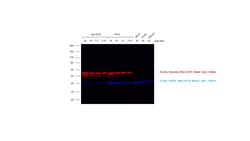 Invitrogen Donkey anti-Rabbit IgG (H+L) Highly Cross-Adsorbed Secondary