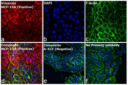 Invitrogen Goat anti-Rabbit IgG (H+L) Cross-Adsorbed Secondary Antibody,