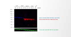Invitrogen Donkey anti-Mouse IgG (H+L) Highly Cross-Adsorbed Secondary