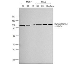 Invitrogen F(ab')2-Goat anti-Human IgG (H+L) Cross-Adsorbed Secondary Antibody,