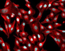 Invitrogen Donkey anti-Mouse IgG (H+L) Highly Cross-Adsorbed Secondary