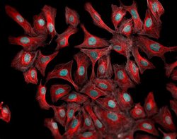 Invitrogen Donkey anti-Mouse IgG (H+L) Highly Cross-Adsorbed Secondary