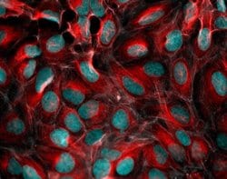 Invitrogen Donkey anti-Mouse IgG (H+L) Highly Cross-Adsorbed Secondary