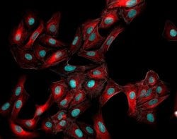 Invitrogen Donkey anti-Rabbit IgG (H+L) Highly Cross-Adsorbed Secondary