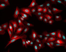 Invitrogen Donkey anti-Rabbit IgG (H+L) Highly Cross-Adsorbed Secondary