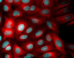 Invitrogen Donkey anti-Rabbit IgG (H+L) Highly Cross-Adsorbed Secondary