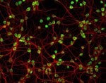 Invitrogen™ Donkey anti-Mouse IgG (H+L) Highly Cross-Adsorbed Secondary Antibody, Alexa Fluor™ Plus 488