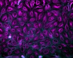 Invitrogen Donkey anti-Mouse IgG (H+L) Highly Cross-Adsorbed Secondary