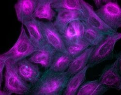 Invitrogen Donkey anti-Mouse IgG (H+L) Highly Cross-Adsorbed Secondary