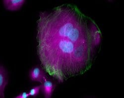 Invitrogen Donkey anti-Mouse IgG (H+L) Highly Cross-Adsorbed Secondary