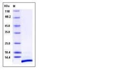 Invitrogen Human CXCL12 Recombinant Protein 50 &mu;g | Buy Online | Invitrogen&trade; | Fisher Scientific