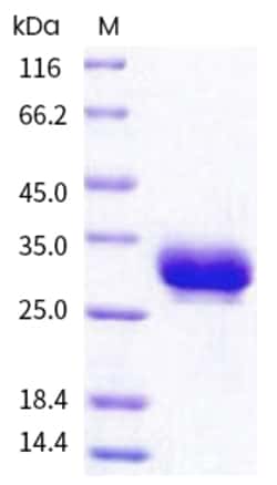 Invitrogen Human Fc gamma RIIA (CD32a) (167 Arg/His) His-tag Recombinant Protein 50 &mu;g | Buy Online | Invitrogen&trade; | Fisher Scientific