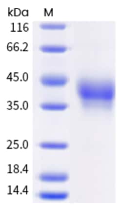 Invitrogen Human PD-1 His-tag Recombinant Protein 50 &mu;g | Buy Online | Invitrogen&trade; | Fisher Scientific