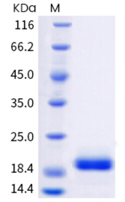 Invitrogen Human IL-6 Recombinant Protein 50 &mu;g | Buy Online | Invitrogen&trade; | Fisher Scientific
