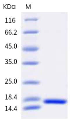 Invitrogen Human TNF-alpha Recombinant Protein 5 &mu;g | Buy Online | Invitrogen&trade; | Fisher Scientific