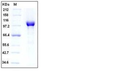 Invitrogen Human PARP1 His-tag Recombinant Protein 5 &mu;g | Buy Online | Invitrogen&trade; | Fisher Scientific