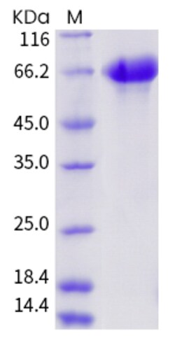 Invitrogen Influenza A H3N2 HA (A/Aichi/2/1968) His-tag Recombinant Protein 50 &mu;g | Buy Online | Invitrogen&trade; | Fisher Scientific