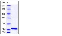 Invitrogen Mouse IL-1 beta Recombinant Protein 5 &mu;g | Buy Online | Invitrogen&trade; | Fisher Scientific