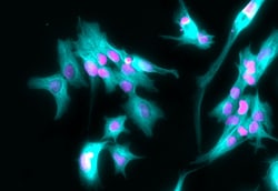 Invitrogen Goat anti-Rabbit IgG (H+L) Highly Cross-Adsorbed Secondary Antibody,