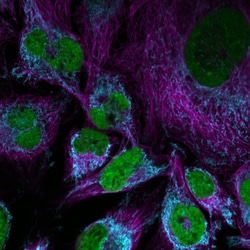 Invitrogen Donkey anti-Mouse IgG (H+L) Highly Cross-Adsorbed Secondary