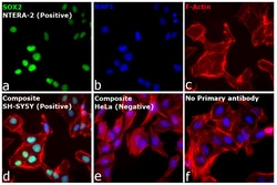 Invitrogen™ Donkey anti-Rat IgG (H+L) Highly Cross-Adsorbed Secondary Antibody, Alexa Fluor™ Plus 488