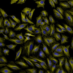 Invitrogen Donkey anti-Rat IgG (H+L) Highly Cross-Adsorbed Secondary Antibody,