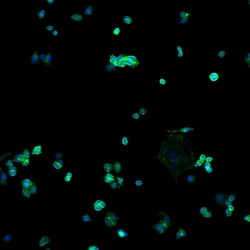 Invitrogen Goat anti-Human IgG (H+L) Cross-Adsorbed Secondary Antibody,