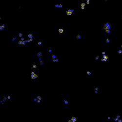 Invitrogen Goat anti-Human IgG (H+L) Cross-Adsorbed Secondary Antibody,
